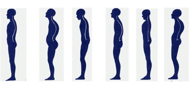 POSTURAL ASSESSMENT